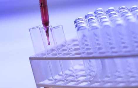 Stati Uniti, fa discutere sì di Fda a test genetico in “autoanalisi”
