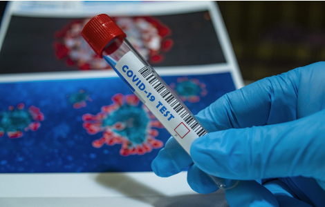 Covid-19, in Emilia Romagna i test sierologici rapidi in farmacia