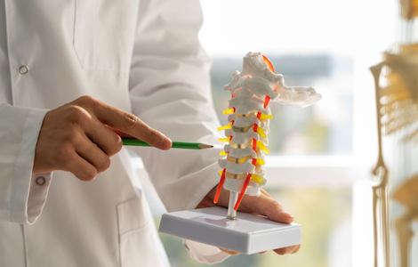 Il ruolo chiave della prevenzione e del farmacista nella lotta all’osteoporosi